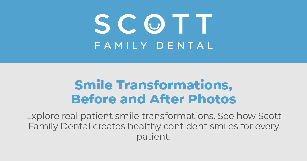 Smile Transformations, Before and After Photos